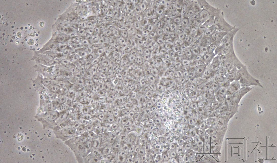 日本科研团队利用iPS细胞使宫颈癌肿瘤变小