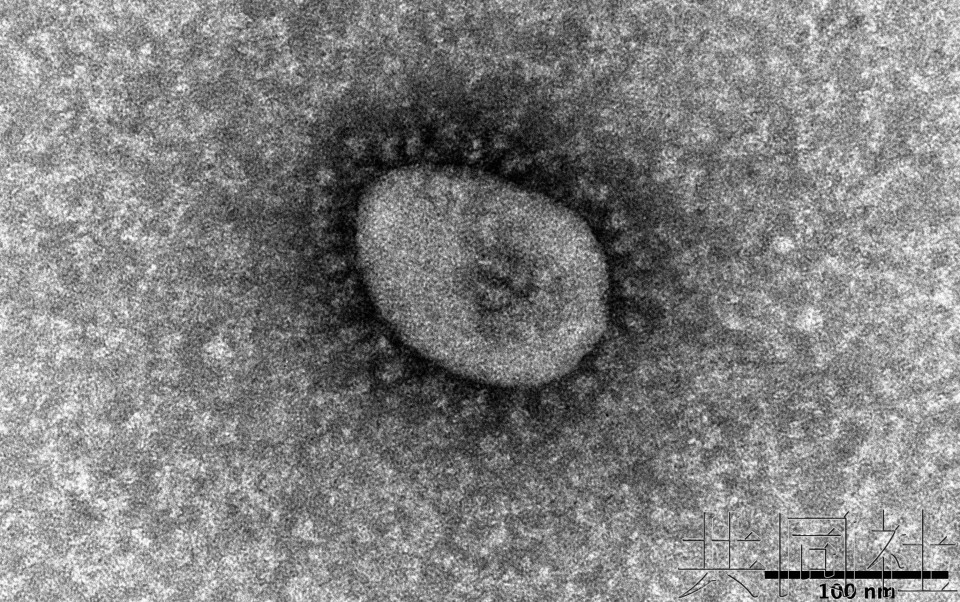 日本25府县新冠感染人数上升 专家建议关注