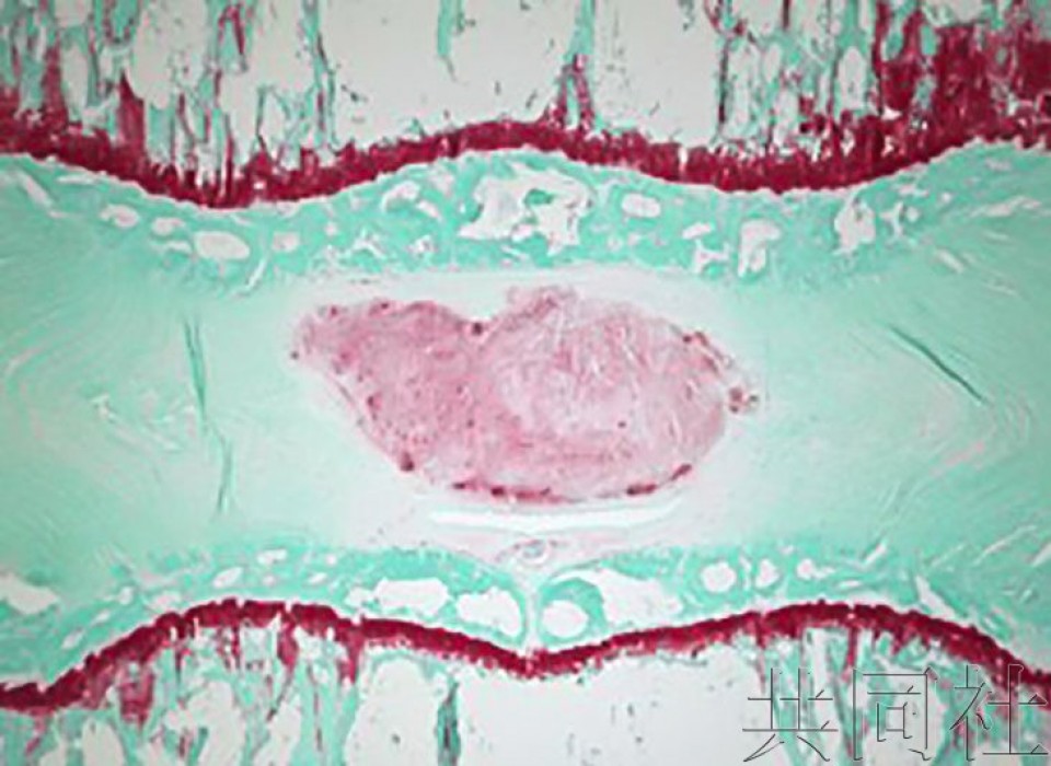 日团队用iPS细胞实现椎间盘组织再生